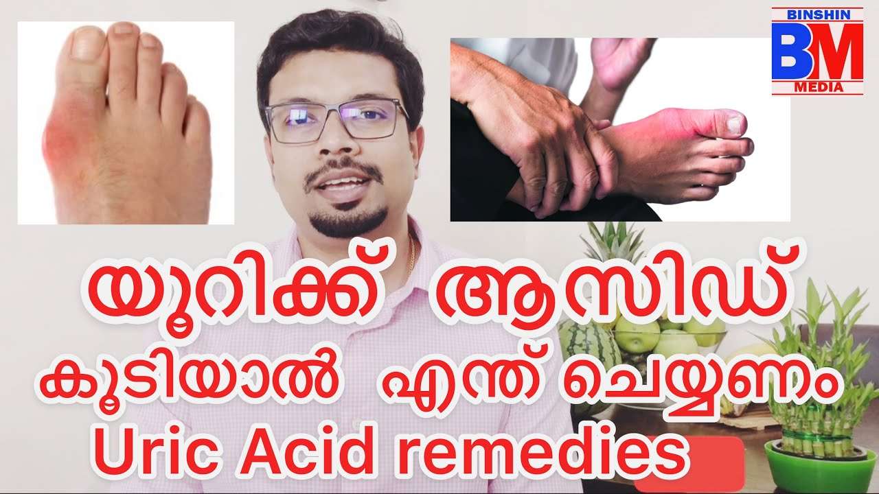 Uric acid remedies in keto diet malayalam
